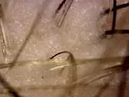 炎症を起こしている頭皮